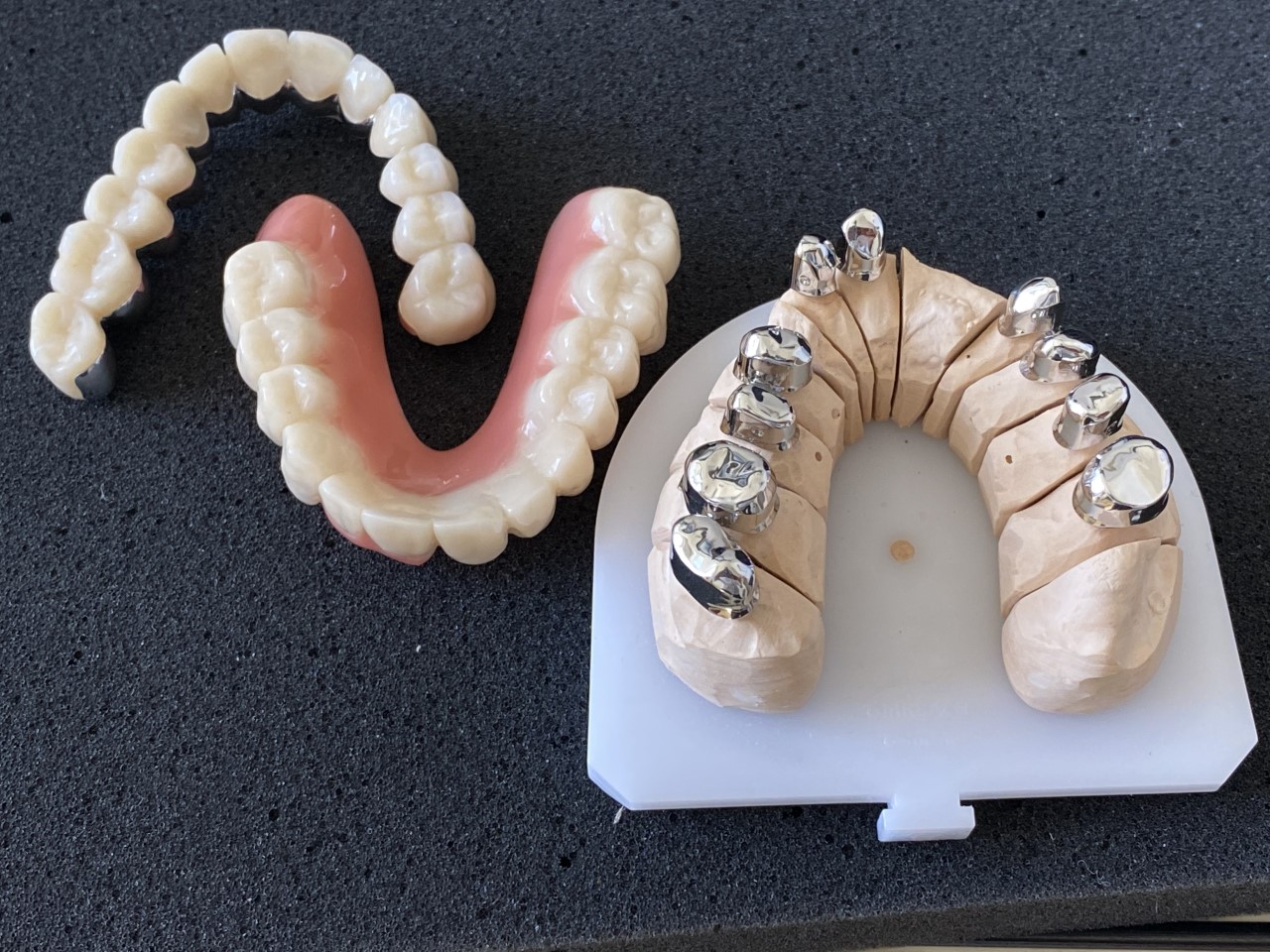 Marburger DK abnehmbare Brücke1